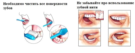 Реферат: Гигиена полости рта